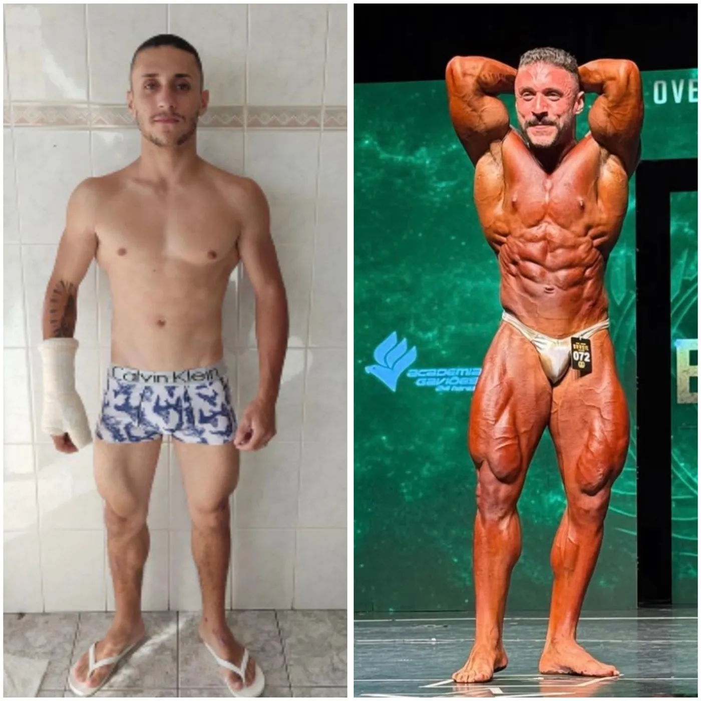 Antes e depois de paciente da consultoria NutriHigu