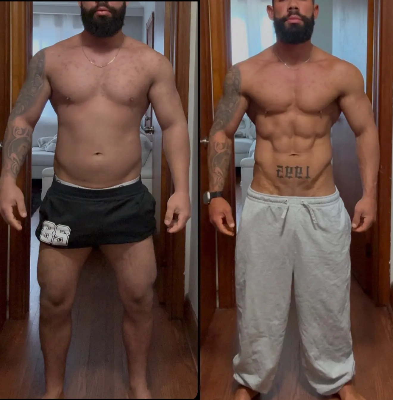 Antes e depois de paciente da consultoria NutriHigu